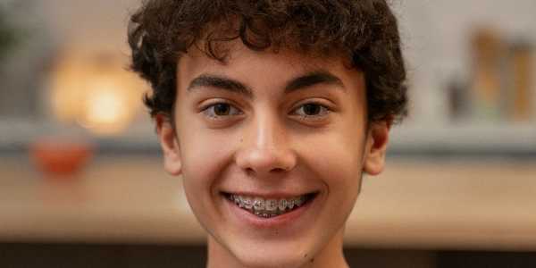 The Ultimate Guide to Choosing the Best Braces for Teens